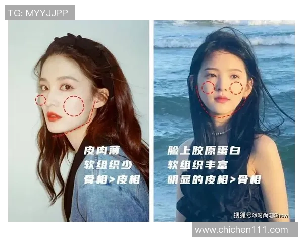 颧骨足球的魅力与挑战探讨如何在运动中保护面部安全与健康